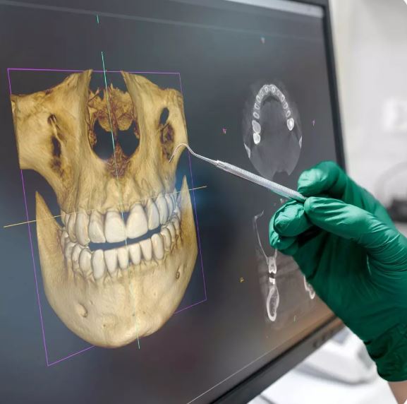 Scanner intra-oral numérique et diagnostic 3D à la clinique dentaire Gaia de Tirana, Albanie
